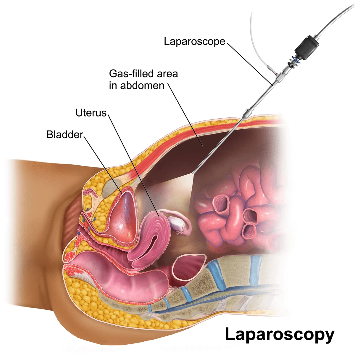 PCOS and PCOD Hormonal Management Treatment Thane