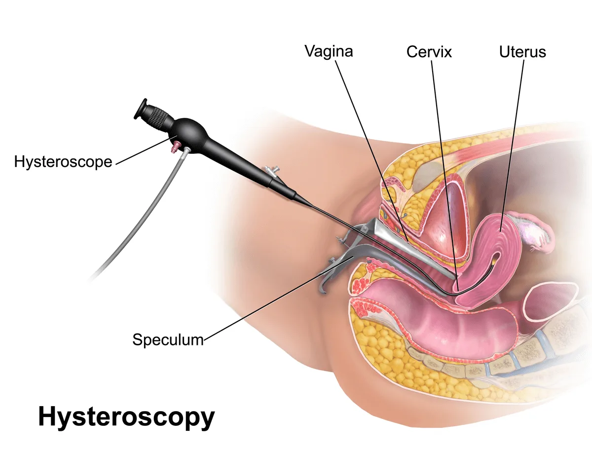 Laparoscopic & Minimally Invasive Gynecological Surgery Thane