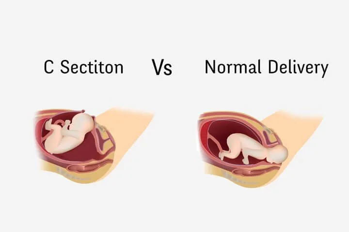 Adolescent Gynecological Counseling Thane